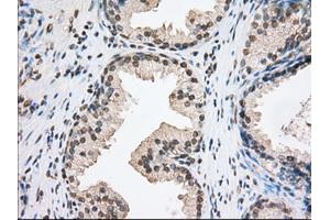 Immunohistochemistry (IHC) image for anti-Transforming, Acidic Coiled-Coil Containing Protein 3 (TACC3) antibody (ABIN1498097) (TACC3 Antikörper)