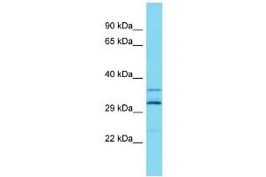 Host: Rabbit Target Name: ARL13A Sample Type: Fetal Liver lysates Antibody Dilution: 1. (ARL13A Antikörper  (Middle Region))