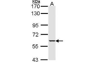 WB Image Sample (30 ug of whole cell lysate) A: Hep G2 , 7. (STK4 Antikörper  (C-Term))