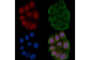ABIN6266277 and ABIN6277434 staining Hela cells(45 min of heat-shock) by IF/ICC. (TCF7 Antikörper  (N-Term))