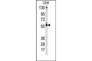 Image no. 1 for anti-Cytochrome P450, Family 2, Subfamily C, Polypeptide 9 (CYP2C9) (Middle Region) antibody (ABIN360247)