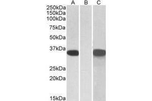 HEK293 lysate (10µg protein in RIPA buffer) overexpressing Human CRISP2 with C-terminal MYC tag probed with AP21265PU-N CRISP2 Antibody (1 µg/ml) in Lane A and probed with anti-MYC Tag (1/1000) in lane C. (CRISP2 Antikörper  (AA 81-93))