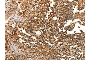 The image on the left is immunohistochemistry of paraffin-embedded Human tonsil tissue using ABIN7130100(LRP12 Antibody) at dilution 1/25, on the right is treated with fusion protein. (LRP12 Antikörper)