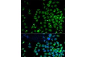 Immunofluorescence analysis of A-549 cells using UBD Polyclonal Antibody