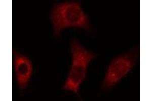 ABIN6277815 staining Hela cells by IF/ICC.