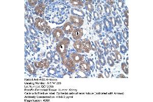 Rabbit Anti-ASS Antibody  Paraffin Embedded Tissue: Human Kidney Cellular Data: Epithelial cells of renal tubule Antibody Concentration: 4. (ASS1 Antikörper  (N-Term))