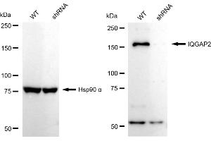 Western blotting analysis using IQGAP2 antibody (ABIN7799123). (Rekombinanter IQGAP2 Antikörper)