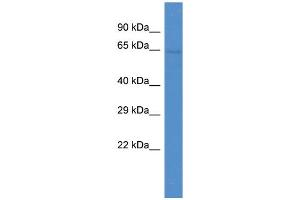 Host:  Rabbit  Target Name:  ZNF284  Sample Type:  OVCAR-3 Whole cell lysates  Antibody Dilution:  1. (ZNF284 Antikörper  (N-Term))