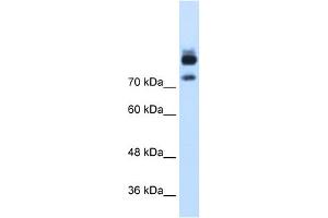 WB Suggested Anti-MTMR1 Antibody Titration:  1. (MTMR1 Antikörper  (C-Term))