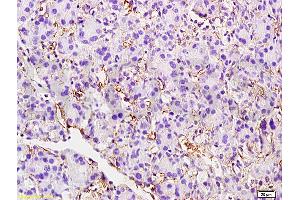 Formalin-fixed and paraffin embedded rat pancreas tissue labeled with Anti-CD105 Polyclonal Antibody, unconjugated(ABIN707561) at 1: 200 followed by incubation with conjugated secondary antibody and DAB staining (Endoglin Antikörper  (AA 58-110))