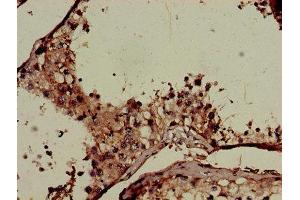 Immunohistochemistry of paraffin-embedded human testis tissue using ABIN7148445 at dilution of 1:100 (CNKSR2 Antikörper  (AA 650-800))