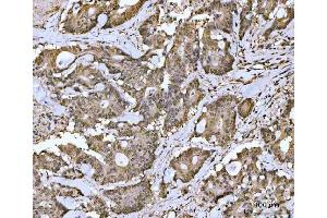 anti-MRE11 Meiotic Recombination 11 Homolog A (S. Cerevisiae) (MRE11A) (AA 278-498) antibody
