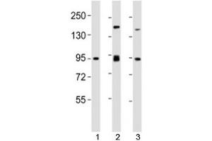 Western blot testing of SUZ12 antibody at 1:2000 dilution. (SUZ12 Antikörper  (AA 375-408))