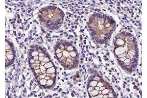 ABIN6268764 at 1/100 staining human colon tissue sections by IHC-P.