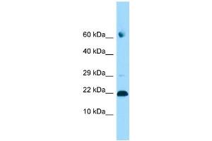 WB Suggested Anti-ADAT2 Antibody Titration: 1. (ADAT2 Antikörper  (C-Term))