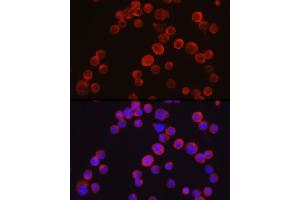 Immunofluorescence analysis of Jurkat cells using Tec Rabbit pAb (ABIN6128353, ABIN6148988, ABIN6148989 and ABIN6213654) at dilution of 1:50 (40x lens).