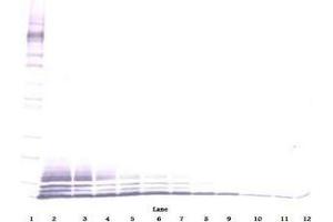 Image no. 3 for anti-Chemokine (C-C Motif) Ligand 5 (CCL5) antibody (ABIN465616) (CCL5 Antikörper)
