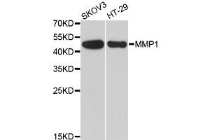 Western blot analysis of extracts of various cell lines, using MMP1 antibody. (MMP1 Antikörper)
