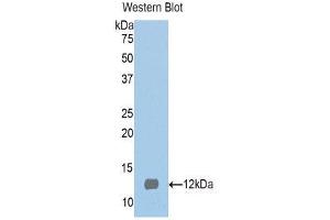 Western Blotting (WB) image for anti-S100 Protein (S100) (AA 2-94) antibody (ABIN1171955) (S100 Protein (S100) (AA 2-94) Antikörper)