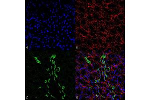 Immunohistochemistry analysis using Rabbit Anti-UT-A1 Polyclonal Antibody (ABIN863205). (Solute Carrier Family 14 (Urea Transporter, Kidney) Member 2 (SLC14A2) (AA 911-929) Antikörper)