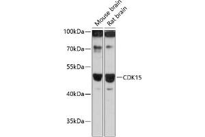 Western blot analysis of extracts of various cell lines, using CDK15 antibody (ABIN6131335, ABIN6138309, ABIN6138310 and ABIN6217056) at 1:3000 dilution. (Cyclin-Dependent Kinase 15 (ALS2CR7) (AA 271-400) Antikörper)