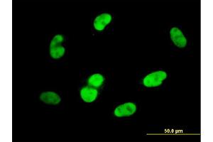 Immunofluorescence of monoclonal antibody to SOX9 on HepG2 cell.