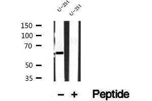 Western blot analysis of extracts of U-251 cells, using Sur-8 antibody. (SHoc2/Sur8 Antikörper  (C-Term))