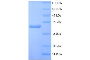 Desmoplakin (DSP) (AA 78-300), (partial) protein (His tag)