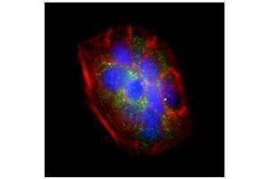 Immunofluorescence (IF) image for anti-Interferon Regulatory Factor 6 (IRF6) antibody (ABIN2665207)
