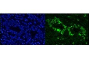IF analysis of Cbx8 using anti-Cbx8 antibody (ABIN7599341). (CBX8 Antikörper  (AA 1-389))