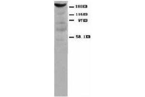 Image no. 1 for anti-Myosin, Light Chain 1, Alkali, Skeletal, Fast (MYL1) antibody (ABIN1502212) (MYL1 Antikörper)