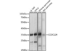 Western blot analysis of extracts of various cell lines, using CCDC124 antibody  at 1:1000 dilution. (CCDC124 Antikörper  (AA 1-223))
