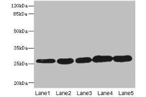Western blot All lanes: GSTK1 antibody at 0.