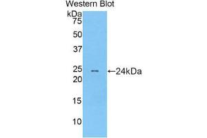Western Blotting (WB) image for anti-Myosin, Light Chain 12B, Regulatory (MYL12B) (AA 5-172) antibody (ABIN1859938) (MYL12B Antikörper  (AA 5-172))