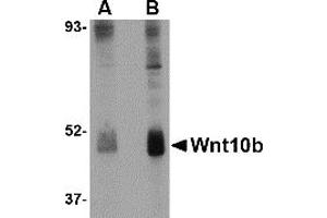 Western Blotting (WB) image for anti-Wingless-Type MMTV Integration Site Family, Member 10B (WNT10B) (Middle Region) antibody (ABIN1031166)
