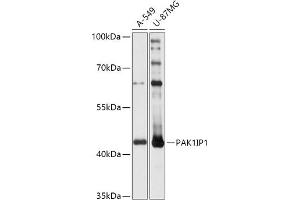 Western blot analysis of extracts of various cell lines, using PIP1 antibody (ABIN7269160) at 1:1000 dilution. (PAK1IP1 Antikörper  (AA 1-392))