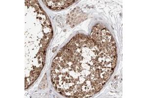 Immunohistochemical staining of human testis with MAGEB4 polyclonal antibody  shows moderate cytoplasmic and nuclear positivity in cells in seminiferus ducts at 1:200-1:500 dilution. (MAGEB4 Antikörper)