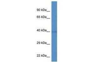 Image no. 1 for anti-WD Repeat Domain 92 (WDR92) (AA 155-204) antibody (ABIN6746356) (WDR92 Antikörper  (AA 155-204))