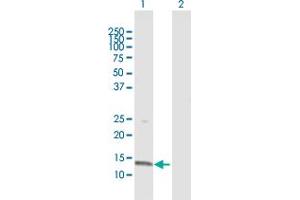 Western Blot analysis of CDA expression in transfected 293T cell line by CDA MaxPab polyclonal antibody. (CDA Antikörper  (AA 1-146))