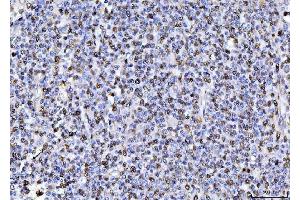 IHC analysis of PCNA using anti-PCNA antibody (ABIN7599181).