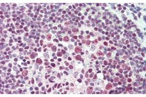 Immunohistochemistry (IHC) image for anti-Protein tyrosine Phosphatase, Receptor Type, J (PTPRJ) (AA 567-842) antibody (ABIN7441778)