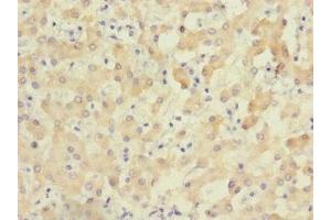 Immunohistochemistry of paraffin-embedded human liver tissue using ABIN7176327 at dilution of 1:100 (ZNF462 Antikörper  (AA 2223-2506))