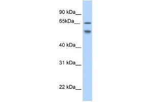 WB Suggested Anti-RBM35B Antibody Titration:  2. (ESRP2 Antikörper  (N-Term))