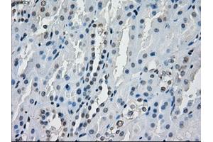 Immunohistochemical staining of paraffin-embedded endometrium tissue using anti-AURKCmouse monoclonal antibody. (Aurora Kinase C Antikörper)