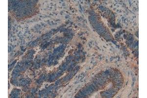 Used in DAB staining on fromalin fixed paraffin- embedded liver tissue (Biglycan Antikörper  (AA 48-158))