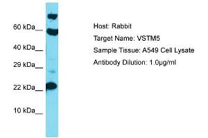 Host: Rabbit Target Name: VSTM5 Sample Type: A549 Whole Cell lysates Antibody Dilution: 1. (VSTM5 Antikörper  (C-Term))