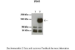 Lanes:   1: 20ug HEK293T no transfection, 2: 20ug HEK293T 3Flag-MDA5/IFIH1  Primary Antibody Dilution:   1:1000  Secondary Antibody:   Anti-rabbit HRP  Secondary Antibody Dilution:   1:1000  Gene Name:   IFIH1  Submitted by:   Dr. (IFIH1 Antikörper  (Middle Region))