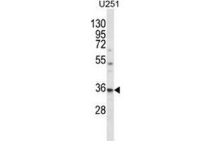 VPS37B Antibody (Center) western blot analysis in U251 cell line lysates (35 µg/lane). (VPS37B Antikörper  (Middle Region))