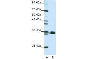 WB Suggested Anti-HNRPA1 Antibody Titration:  1. (HNRNPA1 Antikörper  (N-Term))