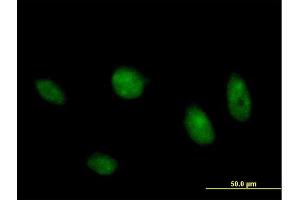 Immunofluorescence of purified MaxPab antibody to MAPK8 on HeLa cell. (JNK Antikörper  (AA 1-427))